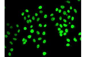 Immunofluorescence analysis of MCF7 cell using REST antibody.