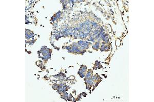 IHC analysis of GRPEL1 using anti-GRPEL1 antibody (ABIN7602643). (GRPEL1 antibody  (AA 90-217))
