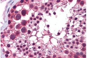 Human Testis: Formalin-Fixed, Paraffin-Embedded (FFPE) (HDAC6 antibody  (N-Term))