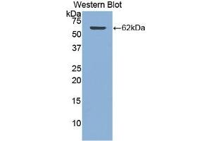 Detection of Recombinant CTSA, Human using Polyclonal Antibody to Cathepsin A (CTSA) (CTSA antibody  (AA 215-470))