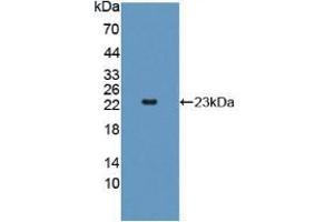 Figure. (Adenylate Kinase 2 antibody  (AA 64-232))