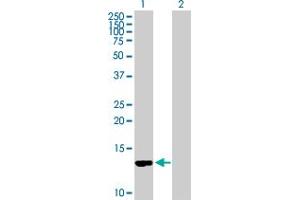 Western Blot analysis of CD59 expression in transfected 293T cell line by CD59 MaxPab polyclonal antibody. (CD59 antibody  (AA 1-128))