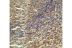 MEF2A antibody immunohistochemistry analysis in formalin fixed and paraffin embedded human tonsil tissue. (MEF2A antibody  (AA 453-479))