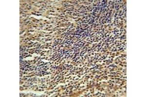 MEF2A antibody immunohistochemistry analysis in formalin fixed and paraffin embedded human tonsil tissue.