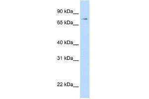 WB Suggested Anti-STAT1 Antibody Titration: 0. (STAT1 antibody  (N-Term))