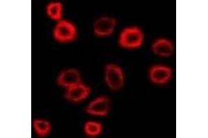 Immunofluorescent analysis of N-WASP staining in SW480 cells. (Neural Wiskott-Aldrich syndrome protein (WASL) antibody)