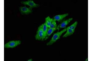 Immunofluorescent analysis of Hela cells using ABIN7142618 at dilution of 1:100 and Alexa Fluor 488-congugated AffiniPure Goat Anti-Rabbit IgG(H+L) (Serotonin Receptor 1E antibody  (AA 203-291))