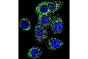 Immunofluorescence (IF) image for anti-Caspase 12 (Gene/pseudogene) (CASP12) antibody (ABIN2996496) (Caspase 12 antibody)