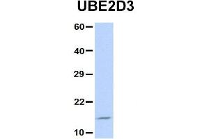 Host:  Rabbit  Target Name:  UBE2D3  Sample Type:  Jurkat  Antibody Dilution:  1. (UBE2D3 antibody  (N-Term))