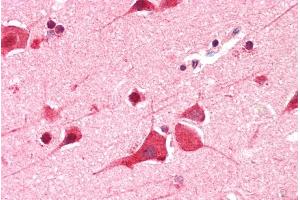 ABIN185580 (5µg/ml) staining of paraffin embedded Human Cortex. (DDX6 antibody  (C-Term))