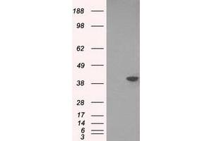 HEK293T cells were transfected with the pCMV6-ENTRY control (Left lane) or pCMV6-ENTRY DNTTIP1 (Right lane) cDNA for 48 hrs and lysed. (DNTTIP1 antibody)