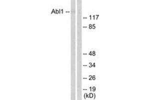 Western blot analysis of extracts from COS7 cells, treated with Adriamycin 0. (ABL1 antibody  (AA 156-205))