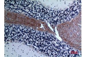 Immunohistochemistry (IHC) analysis of paraffin-embedded Rat Brain, antibody was diluted at 1:100. (CCL26 antibody  (Internal Region))