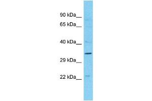 Western Blotting (WB) image for anti-Melanoma Antigen Family B, 10 (MAGEB10) (N-Term) antibody (ABIN2791656) (MAGEB10 antibody  (N-Term))