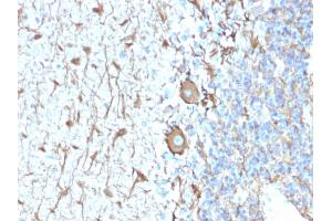 Formalin-fixed, paraffin-embedded human Cerebellum stained with Neurofilament Rabbit Recombinant Monoclonal Antibody (NEFL. (Recombinant NEFH antibody)