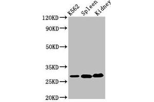Western Blot Positive WB detected in: K562 whole cell lysate, Mouse spleen tissue, Mouse kidney tissue All lanes: CA1 antibody at 6.