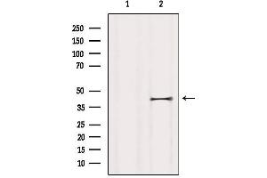 Western blot analysis of extracts from HUVEC, using P2RY5 Antibody. (LPAR6 antibody  (Internal Region))