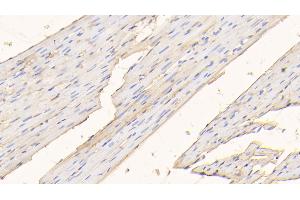 Detection of ALB in Rat Cardiac Muscle Tissue using Polyclonal Antibody to Albumin (ALB) (Albumin antibody)