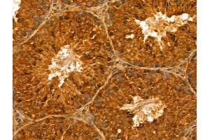 ABIN7094297 and ABIN7098344 at 1/100 staining Mouse testis tissue by IHC-P.