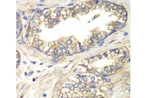Immunohistochemistry of paraffin-embedded Human prostate using SLC4A4 / NBC Polyclonal Antibody at dilution of 1:100 (40x lens).