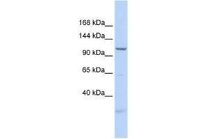 WB Suggested Anti-SKIV2L2 Antibody Titration:  0. (MTR4 antibody  (N-Term))