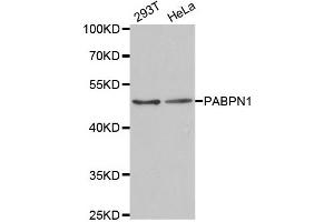Western Blotting (WB) image for anti-Poly A Binding Protein Nuclear 1 (PABPN1) antibody (ABIN1877070)