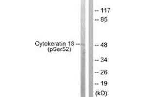 Western blot analysis of extracts from HepG2 cells, using Keratin 18 (Phospho-Ser52) Antibody. (Cytokeratin 18 antibody  (pSer52))