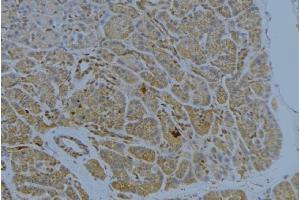 ABIN6272341 at 1/100 staining Human pancreas tissue by IHC-P. (ST14 antibody  (Internal Region))
