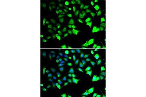 Immunofluorescence analysis of HeLa cell using XIAP antibody.