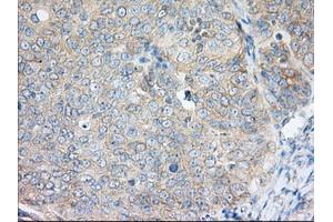 Immunohistochemical staining of paraffin-embedded Human liver tissue using anti-H6PD mouse monoclonal antibody.