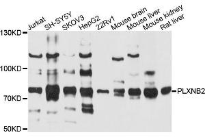 Western blot analysis of extracts of various cells, using PLXNB2 antibody. (Plexin B2 antibody)