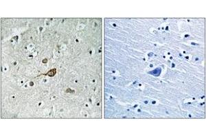 Immunohistochemistry analysis of paraffin-embedded human brain tissue, using c-Abl (Ab-412) Antibody. (ABL1 antibody  (AA 406-455))