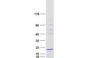 Validation with Western Blot