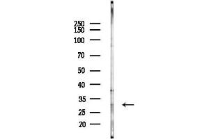 Western blot analysis of lysates from K562 cells(UV 30 min treatment), using SNAP29 Antibody at 1/1000 dilution.