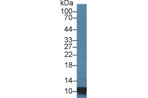 Detection of S100A8 in Porcine Lymph node lysate using Polyclonal Antibody to S100 Calcium Binding Protein A8 (S100A8)