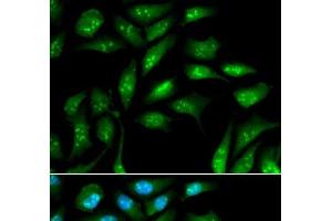 Immunofluorescence analysis of MCF-7 cells using beta 2 Microglobulin Polyclonal Antibody (beta-2 Microglobulin antibody)