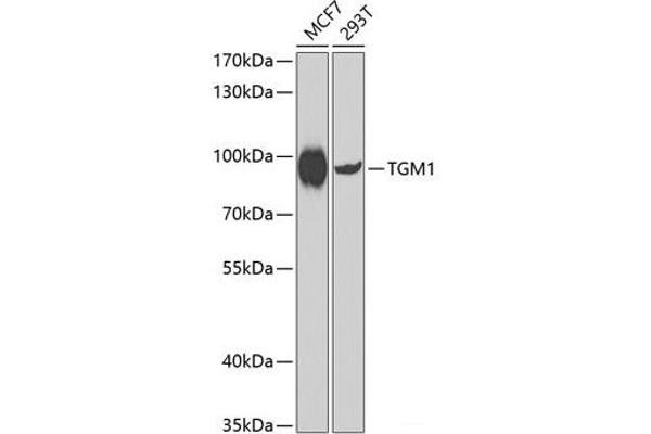 TGM1 Antikörper