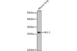 Western blot analysis of extracts of Mouse lung, using Bcl-2 Rabbit pAb (ABIN7265813) at 1:500 dilution. (Bcl-2 antibody  (AA 1-100))
