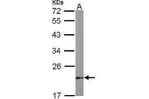 WB Image Sample (50 ug of whole cell lysate) A: mouse stomach 12% SDS PAGE antibody diluted at 1:1000 (Dual Specificity Phosphatase 3 (DUSP3) antibody)