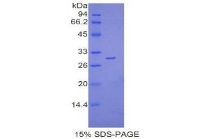 SDS-PAGE (SDS) image for Lymphocyte Antigen 9 (CD229) (AA 384-642) protein (His tag) (ABIN2121560)
