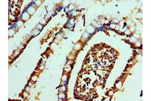 Immunohistochemistry of paraffin-embedded human small intestine tissue using ABIN7161506 at dilution of 1:100 (alpha Defensin 1 antibody  (AA 1-94))