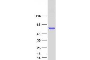 Validation with Western Blot