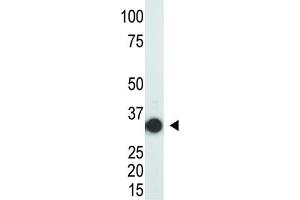 Western Blotting (WB) image for anti-SULT2A (SULT2A) antibody (ABIN3001556) (SULT2A antibody)