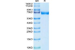 MMP8 Protein (AA 21-467) (His tag)