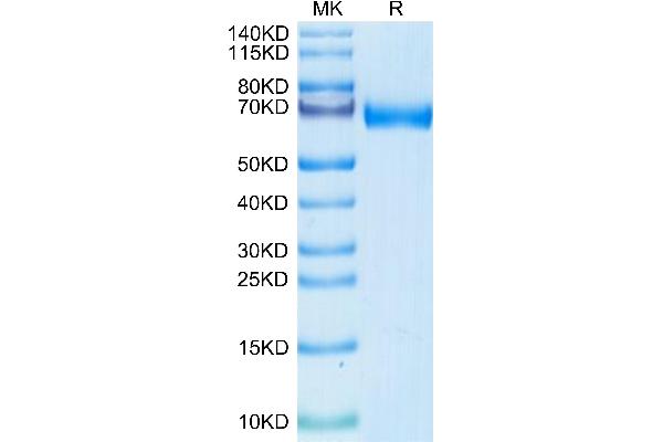 MMP8 Protein (AA 21-467) (His tag)