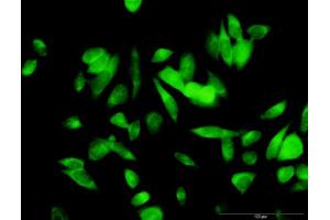 Immunofluorescence of purified MaxPab antibody to ME1 on HeLa cell.