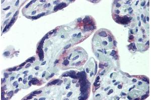 Anti-CXCR6 antibody IHC staining of human placenta. (CXCR6 antibody  (AA 82-142))