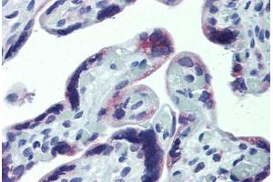 Anti-CXCR6 antibody IHC staining of human placenta. (CXCR6 antibody  (AA 82-142))