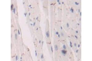 IHC-P analysis of Mouse Tissue, with DAB staining. (Insulin Receptor antibody  (AA 1101-1372))