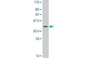Western Blot detection against Immunogen (36. (FOXA2 antibody  (AA 363-457))
